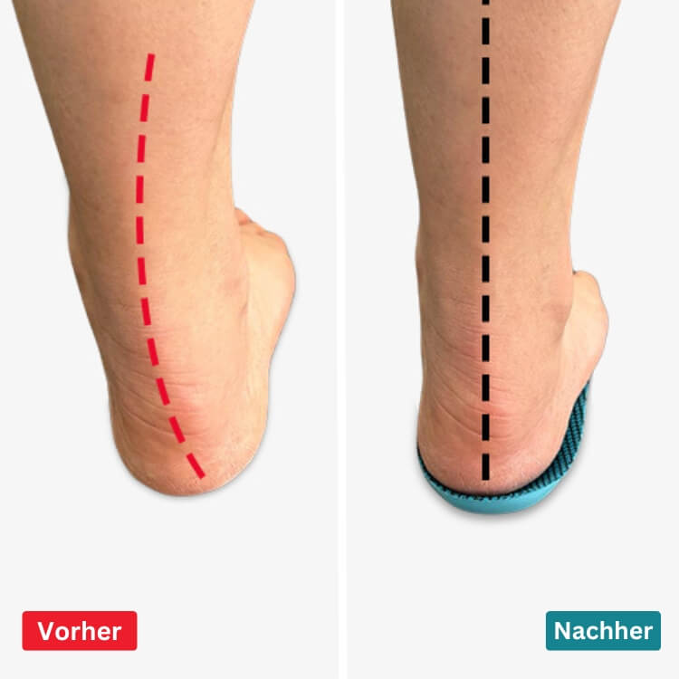 VitaFeet | ComfySole - Schmerzfrei Gehen