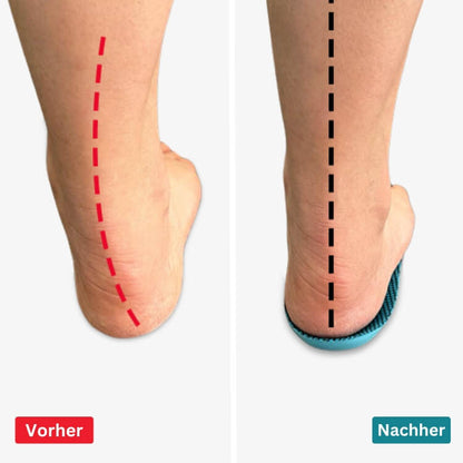 VitaFeet | ComfySole - Schmerzfrei Gehen